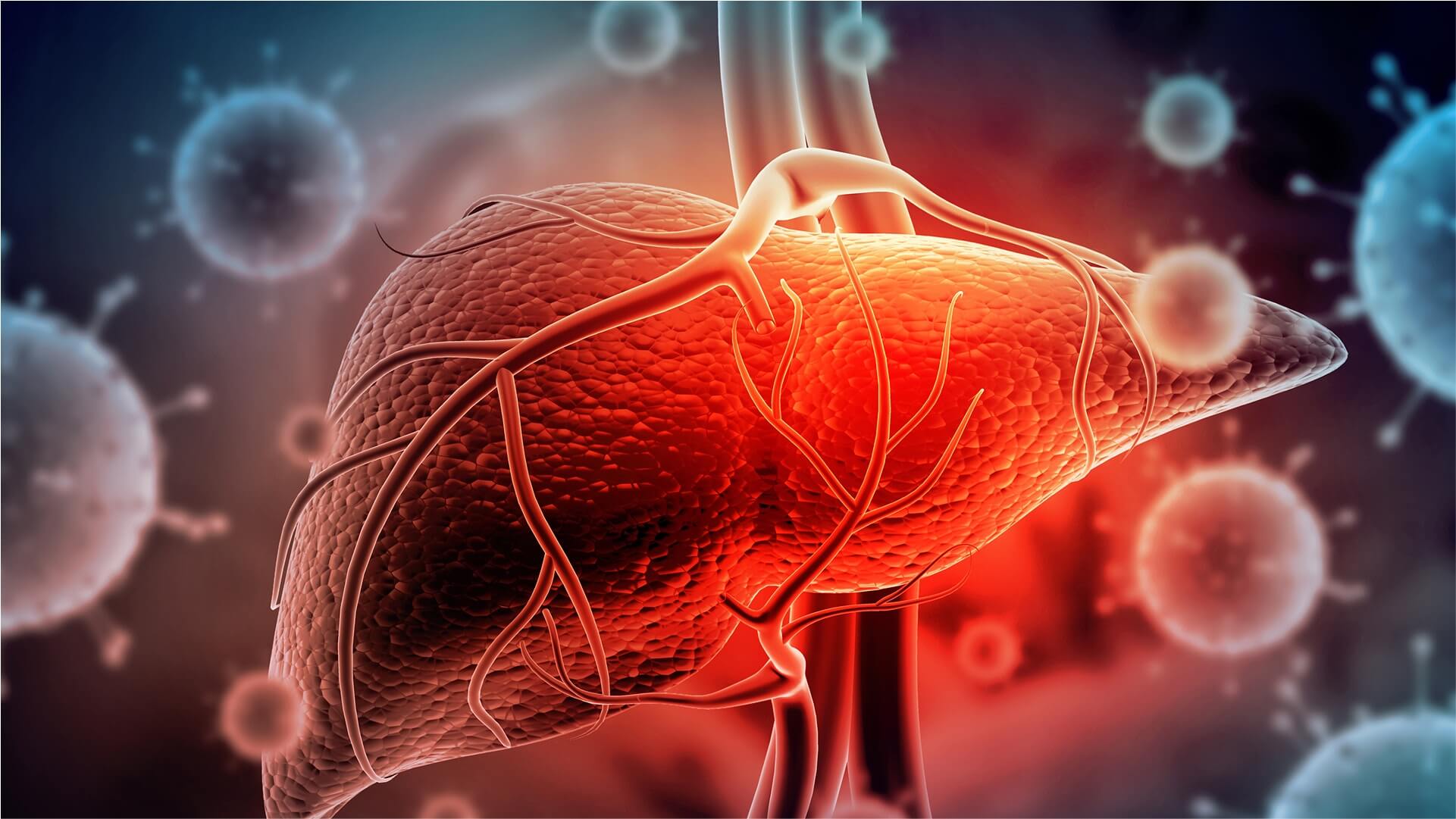 CAR T-Cell Therapy for Autoimmune Diseases