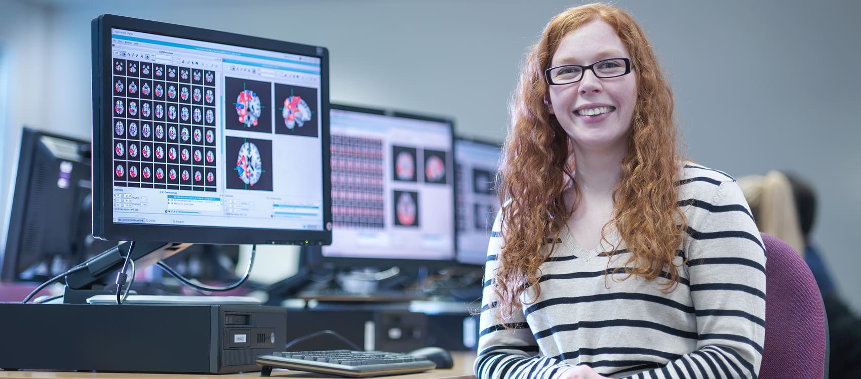 How AI Is Shaping Pain Clinical Trials and Managing Placebo Response Rates