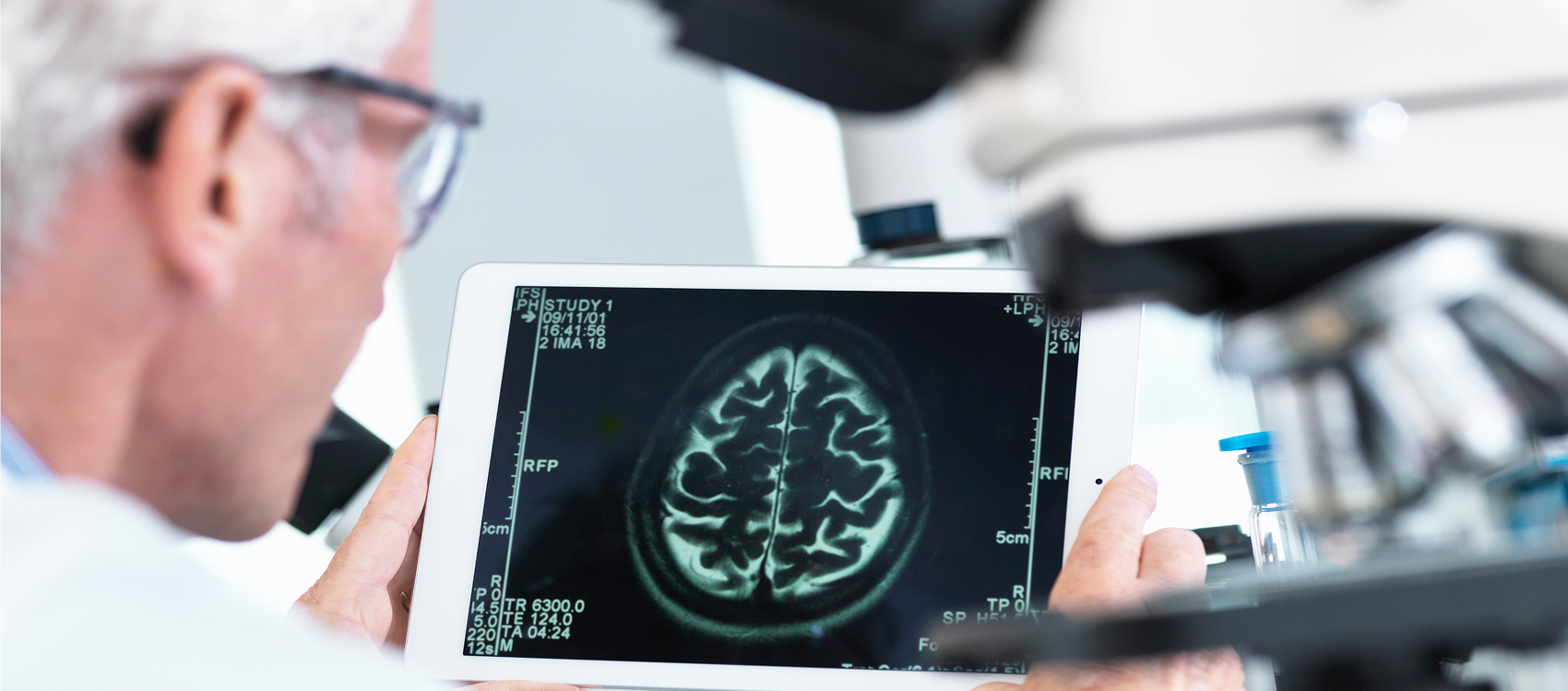 Rethinking Natural History Data in Rare Neurological Disease Trials