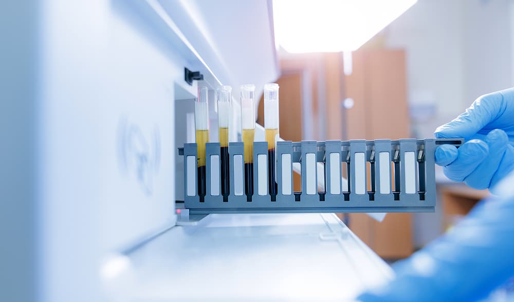 Biomarkers