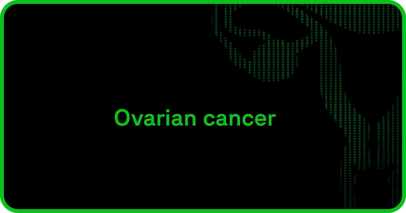 Ovarian cancer: Research biomarkers